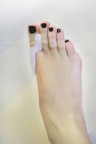 Sobě hallux valgus ortopedické podložky na prst — Stock fotografie