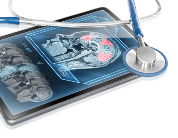Tablet Médico Moderno Exibindo Varredura Atividade Cerebral — Fotografia de Stock
