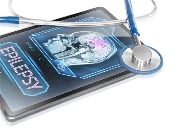 Epilepsy diagnosis displayed on modern medical tablet