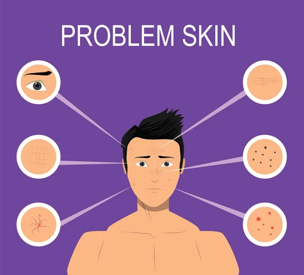 Male with problem skin — Stock Vector