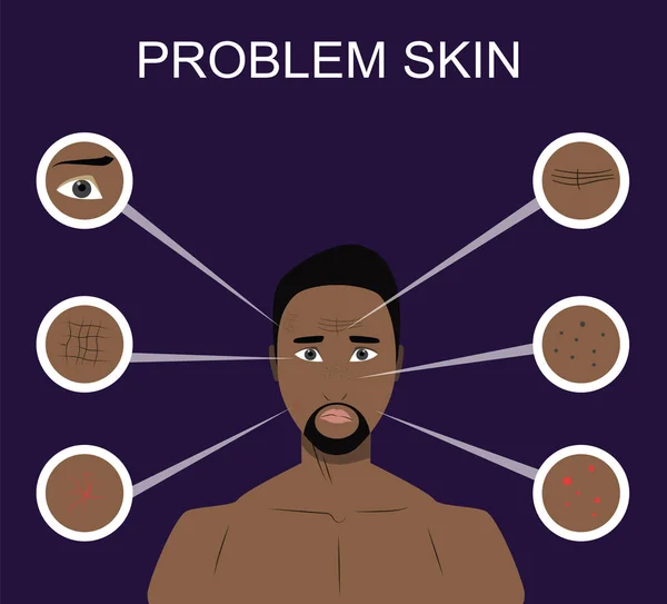 Cuidados faciais, defeitos de pele, problemas de pele . — Vetor de Stock