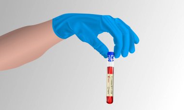 Gri arka plan üzerinde Coronavirus testi (2019-nCOV) ile yapılan gerçekçi test tübü, COVID-2019 üzerinde pozitif sonuç kavramı, vektör illüstrasyonu