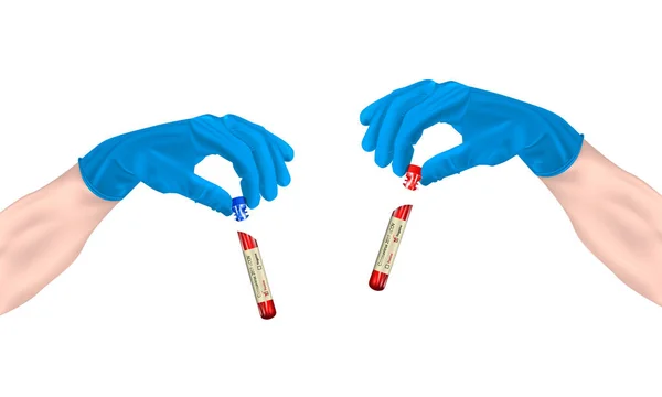 Provetta Realistica Mano Con Test Coronavirus 2019 Ncov Fondo Isolato — Vettoriale Stock