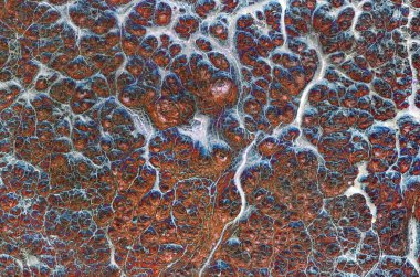 yüzeyi inanılmaz ağaçların.