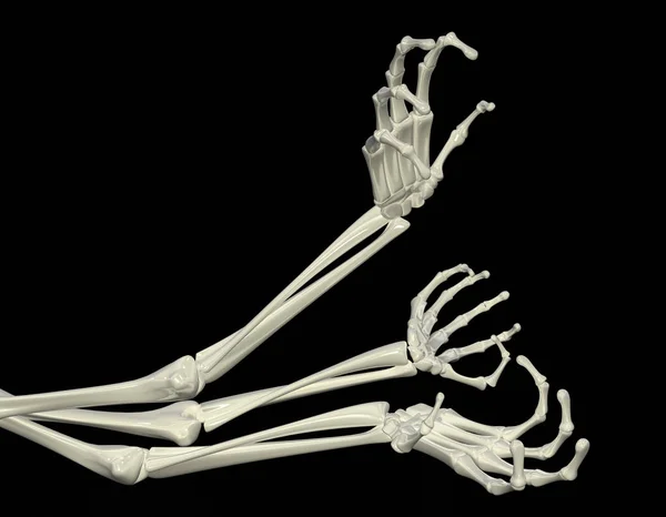 Braccia scheletriche — Foto Stock
