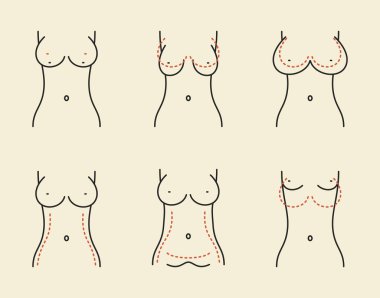 Göğüs cerrahisi örneklerinin çeşitliliği