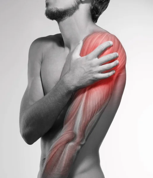 Dor no braço humano. Anatomia do braço humano . — Fotografia de Stock