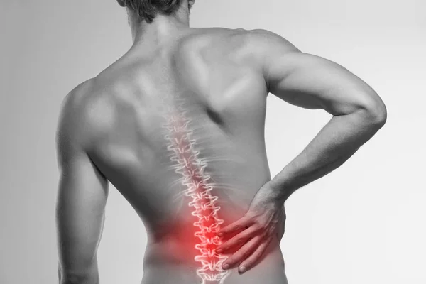 Dolor lumbar — Foto de Stock