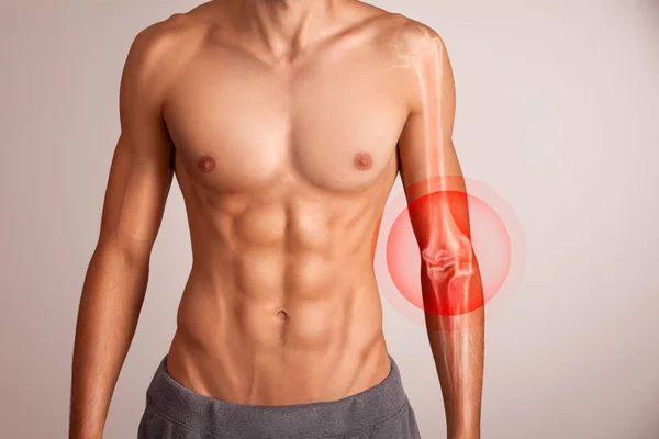 Arm bone pain — Stock Photo, Image