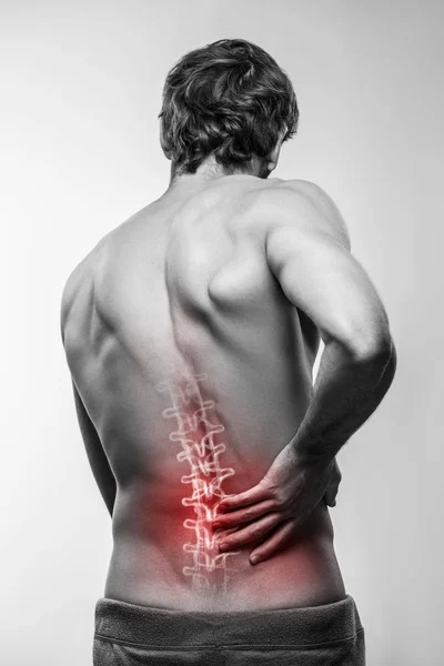 Schmerzen im unteren Rückenbereich — Stockfoto