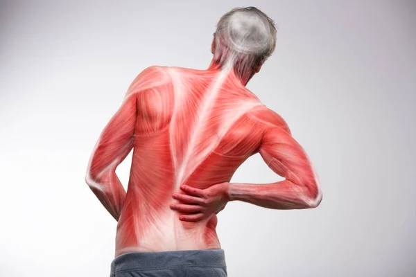 Rückenmuskulatur illustriert Schmerzen — Stockfoto
