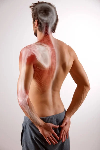 Omuz ve kol ağrısı — Stok fotoğraf