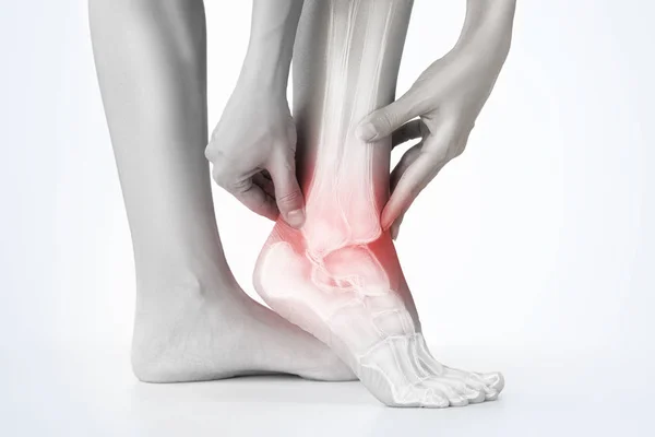 Knöchelschmerzen Schmerzhafter Punkt Fuß — Stockfoto
