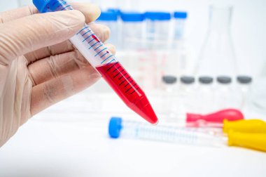 Kırmızı sıvı içeren santrifüj tüpü tutan araştırmacının elleri.