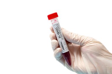 Beyaz lateks eldiven takan ve elinde koronavirüs test kiti tutan bir el. Bulaşıcı salgın konsepti.