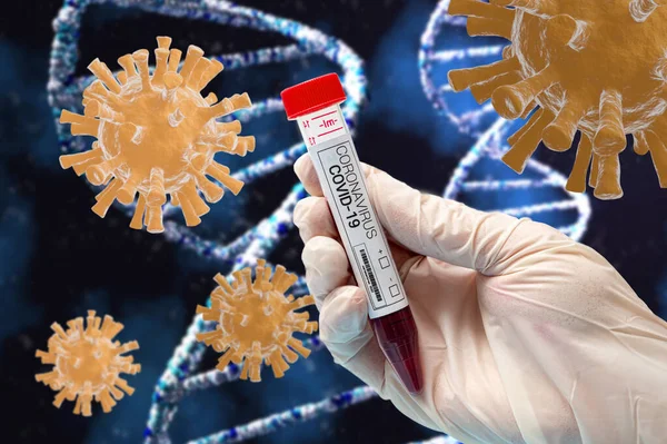 Beyaz lateks eldiven takan ve elinde koronavirüs test kiti tutan bir el. Bulaşıcı salgın konsepti