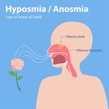 Hyposmia Anosmia, Loss of Sense of Smell Info graphic elements the signs of corona virus Symptoms , Health care concept. clipart