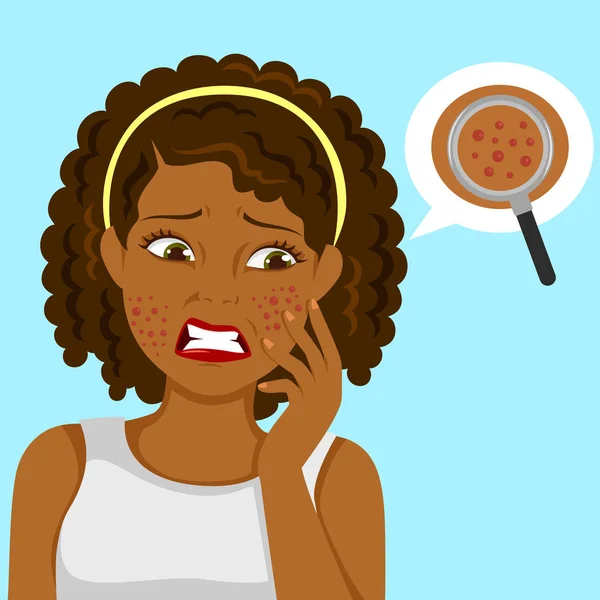 Negro chica con espinillas — Vector de stock