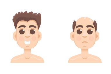 Dökülmeyi aşamaları