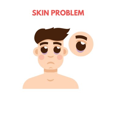 Erkekler cilt sorunu