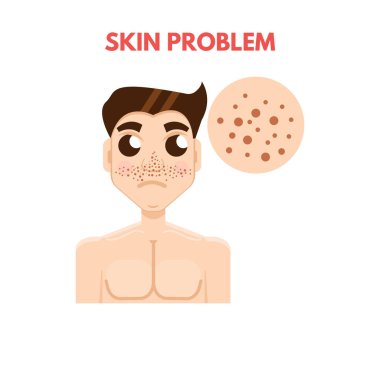 Erkekler cilt sorunu