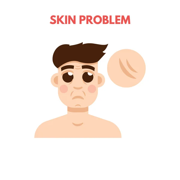 Män hudproblem — Stock vektor