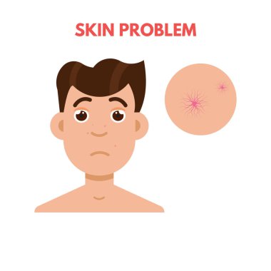 Erkekler cilt sorunu