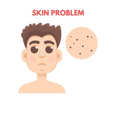 Erkekler cilt sorunu