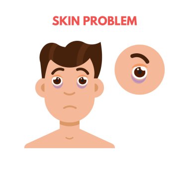 Erkekler cilt sorunu