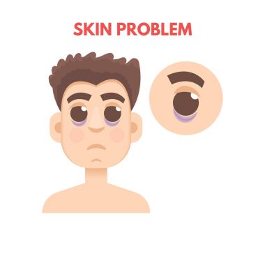 Erkekler cilt sorunu