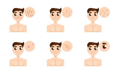 Erkekler cilt sorunu 