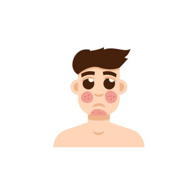 Sedef hastalığı ya da rosacea erkek yüz 
