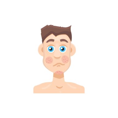 Sedef hastalığı ya da rosacea erkek yüz 