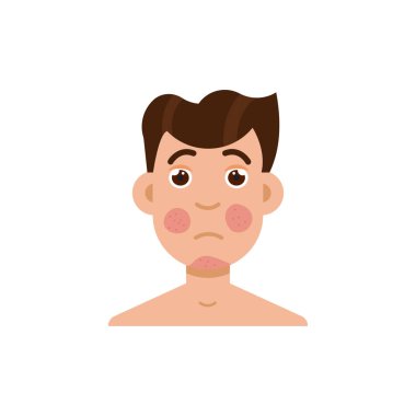 Sedef hastalığı ya da rosacea erkek yüz 