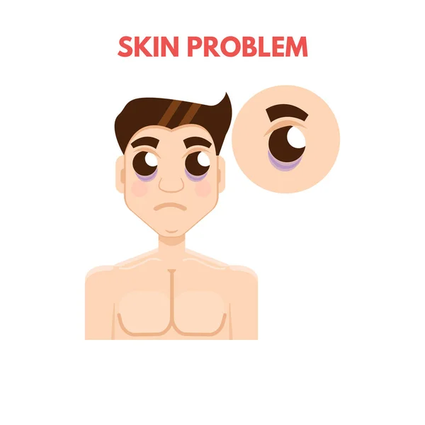 Мужская проблема кожи — стоковый вектор