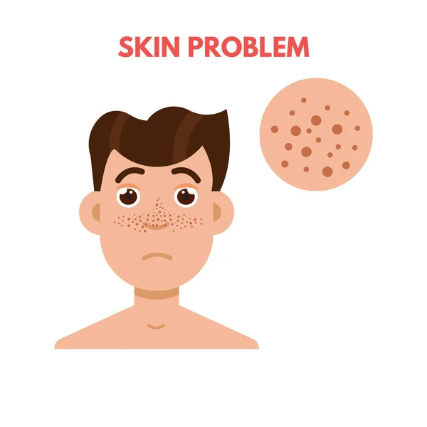 Mannen huid probleem — Stockvector