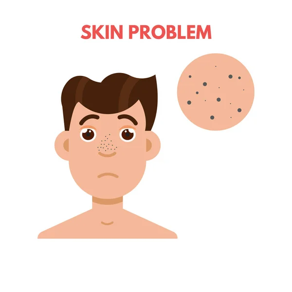 Uomo problema della pelle — Vettoriale Stock