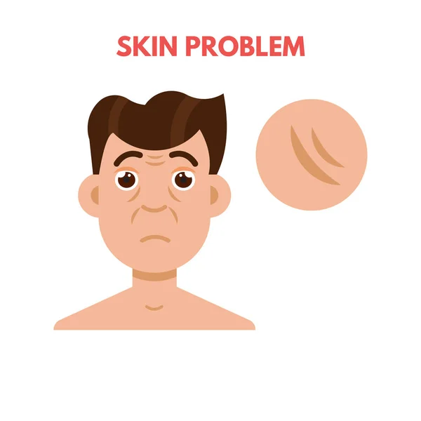 Homme problème de peau — Image vectorielle