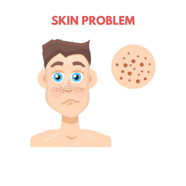 Men skin problem — Stock Vector