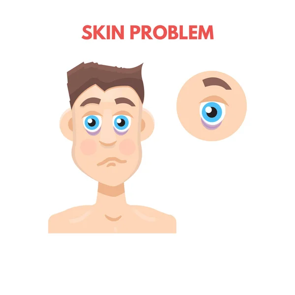 Homme problème de peau — Image vectorielle