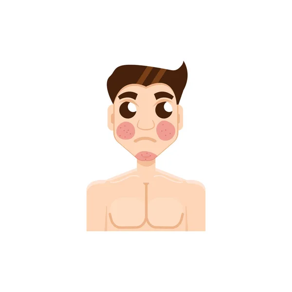 Psoriasis or rosacea men face — Stock Vector