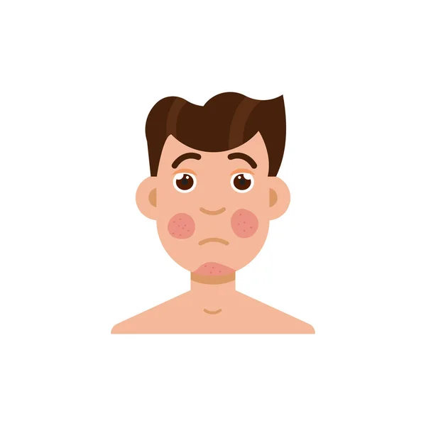 Psoriasis o rosácea cara de hombre — Vector de stock