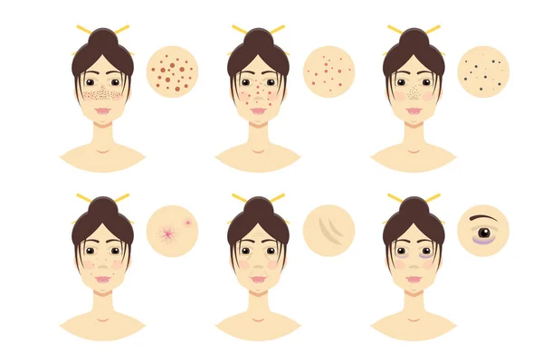 Femmes ayant un problème de peau — Image vectorielle