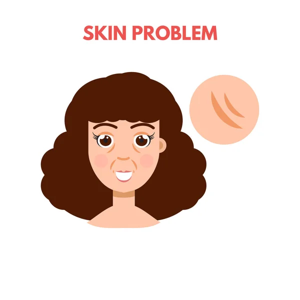 Mujer con problemas de piel — Vector de stock