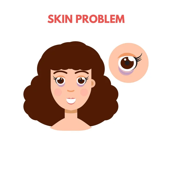 Mujer con problemas de piel — Vector de stock