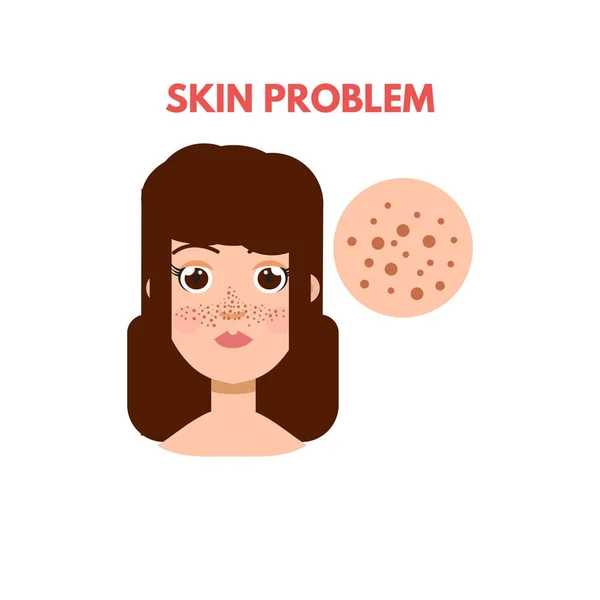 Mujer con problemas de piel — Vector de stock