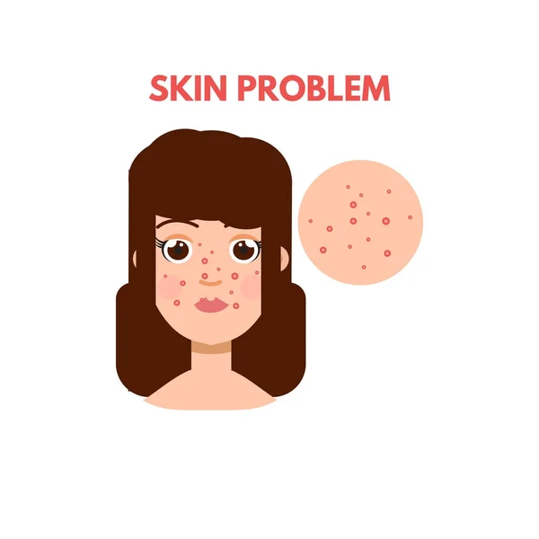 Femme avec problème de peau — Image vectorielle