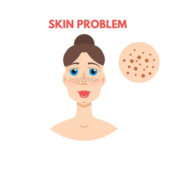 Woman with skin problem — Stock Vector