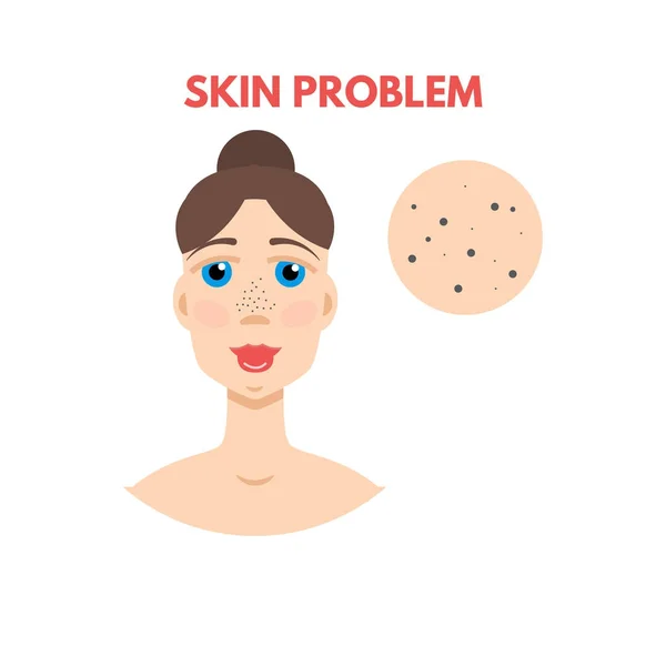 Woman with skin problem — Stock Vector