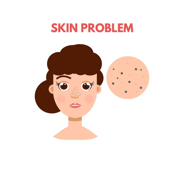 Vrouw met huid probleem — Stockvector